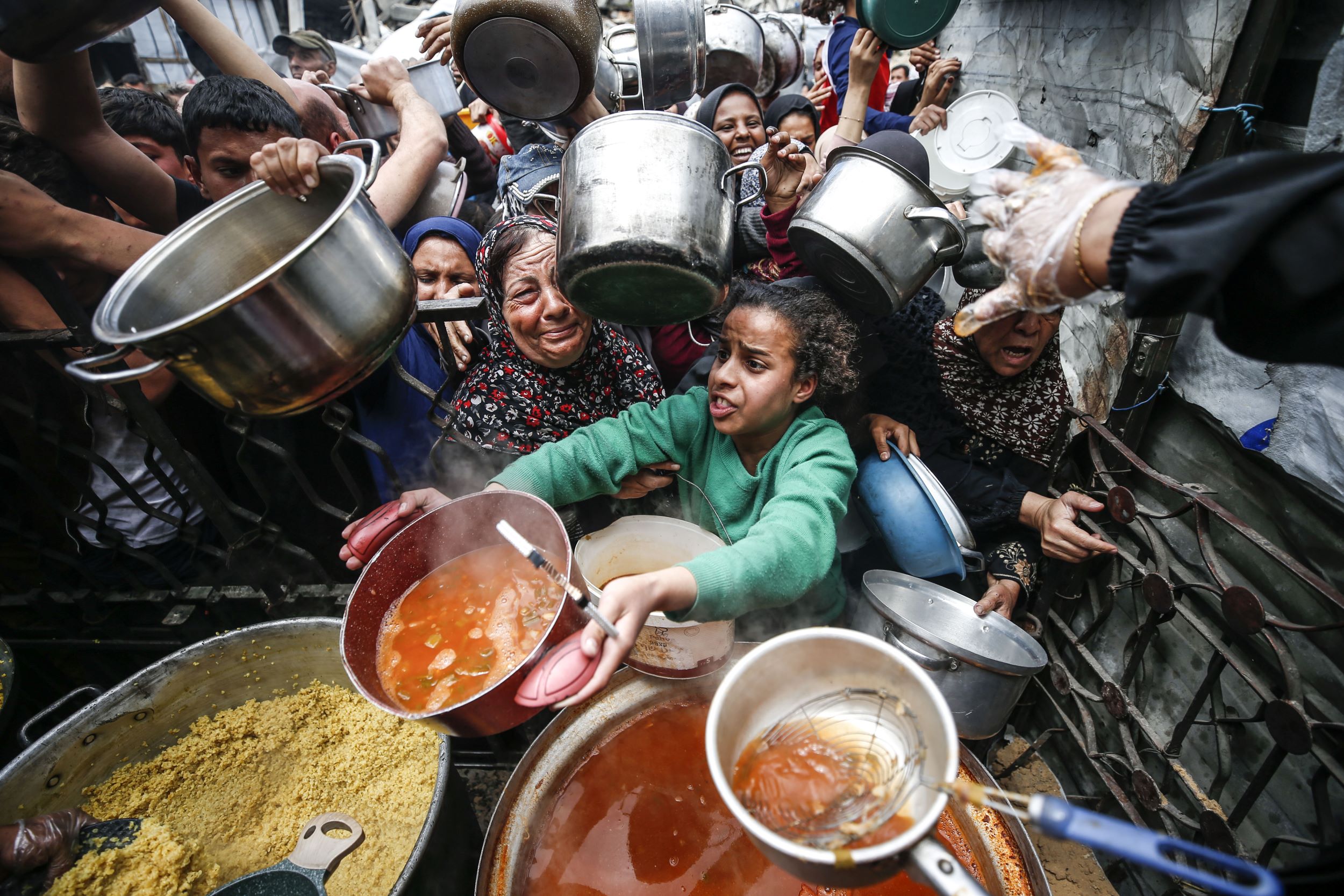 فلسطين – وقد أدت القيود المتعمدة على الغذاء والمساعدات إلى مستويات مثيرة للقلق من سوء التغذية في غزة