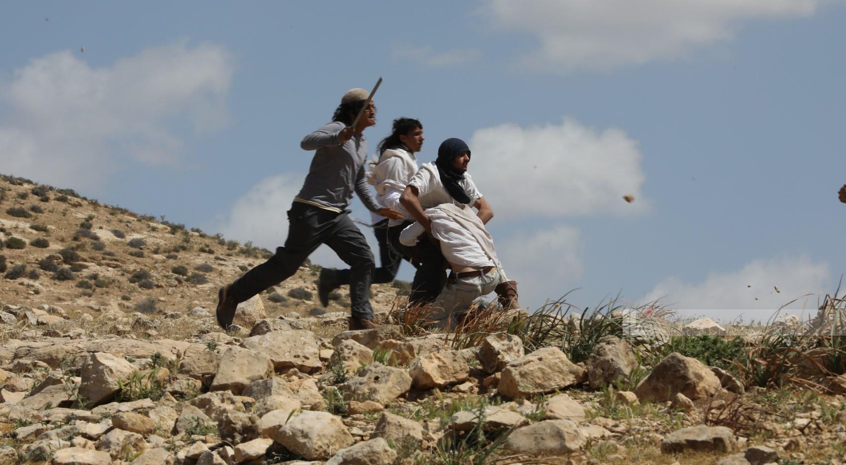 فلسطين – إصابة 7 مواطنين واعتقال 3 آخرين خلال اعتداء مستوطنين في مسافر يطا فلسطين – إصابة 7 مواطنين واعتقال 3 آخرين خلال اعتداء مستوطنين في مسافر يطا